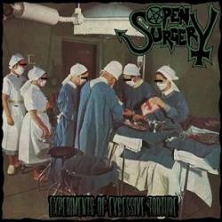 Open Surgery : Experiments of Excessive Torture